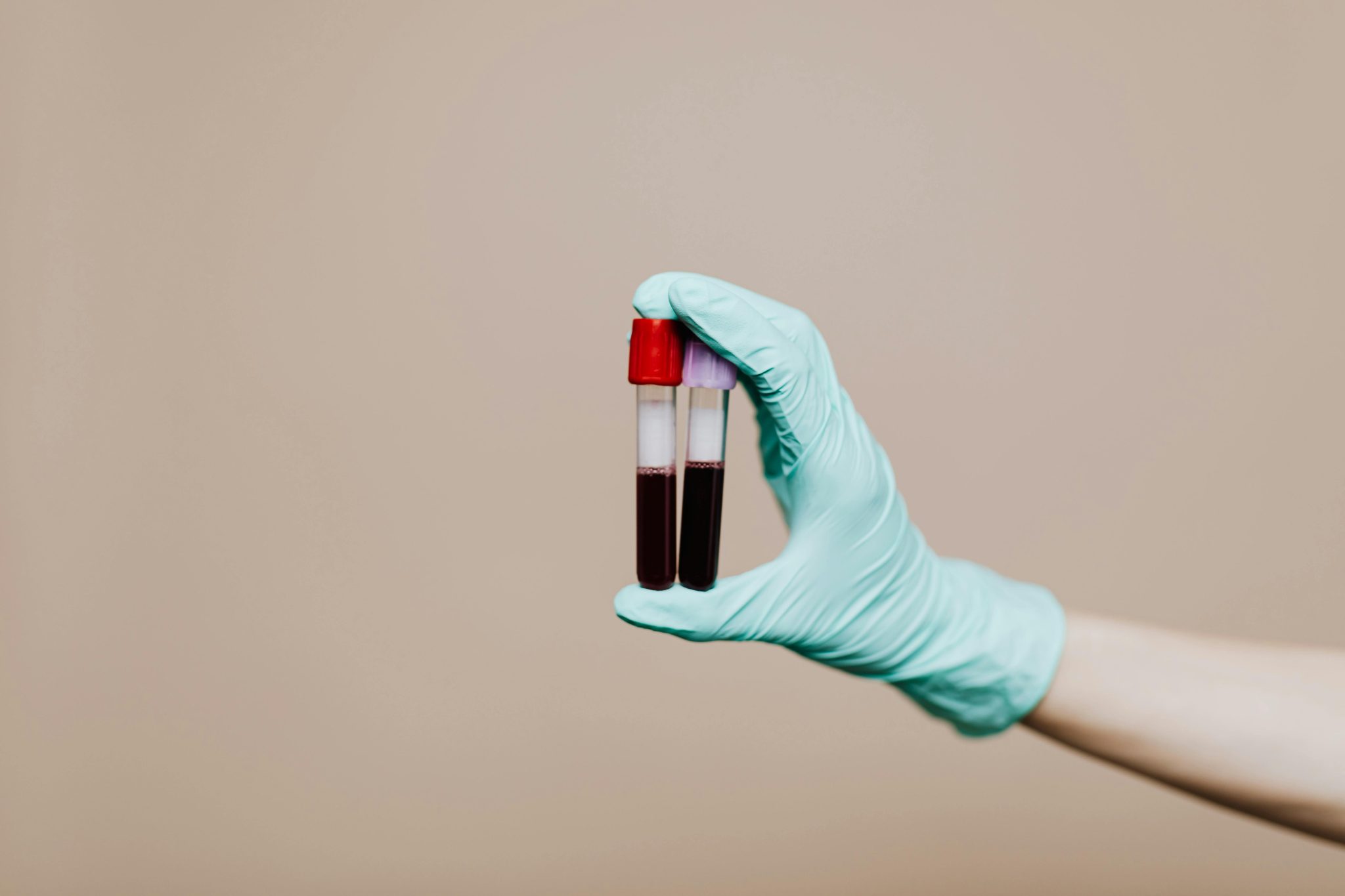 private-blood testing-london