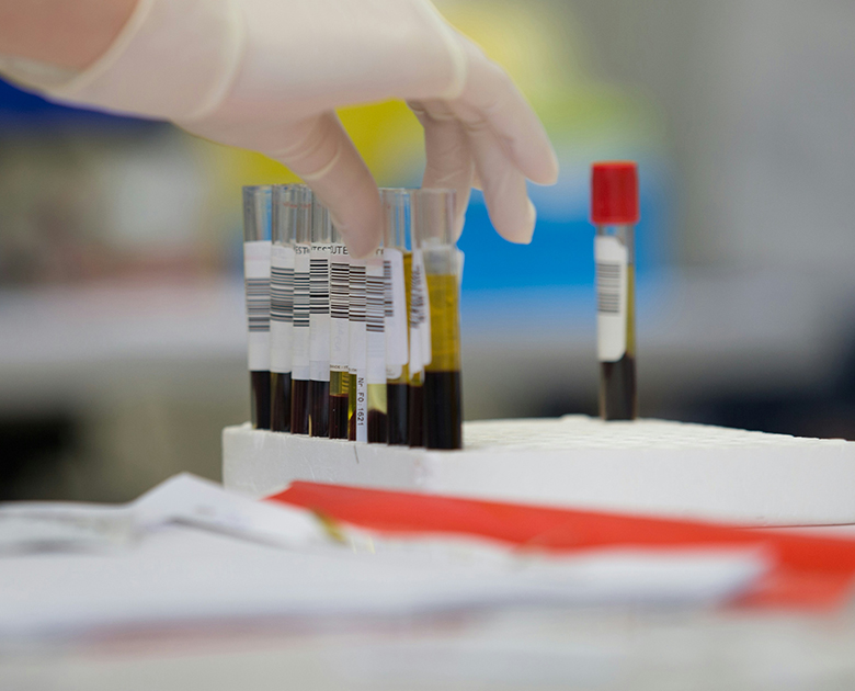 private-blood-tests-london